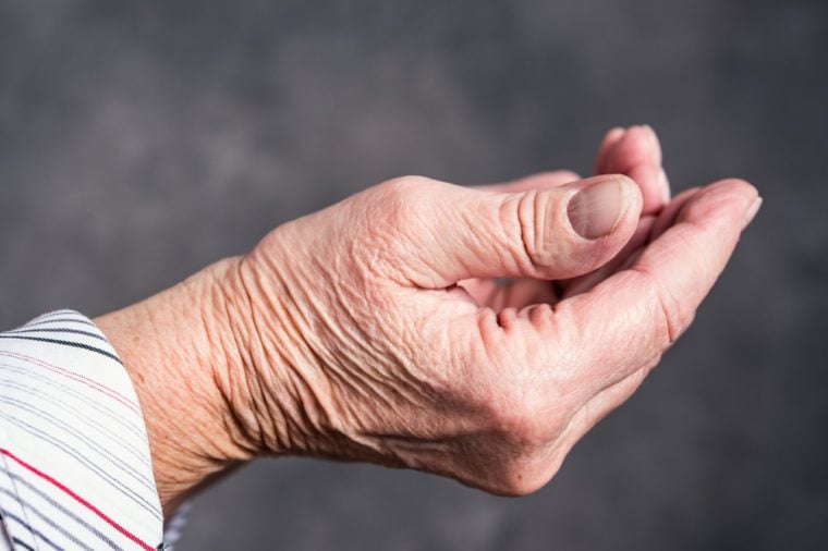 open hands of elderly woman in front of dark background