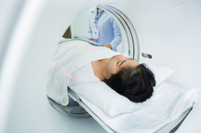 Asian women are entering the brain with a Ct scan