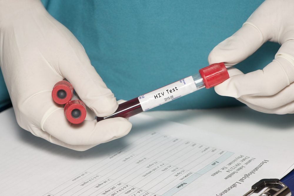Blood collection tube with HIV test label held by technician.