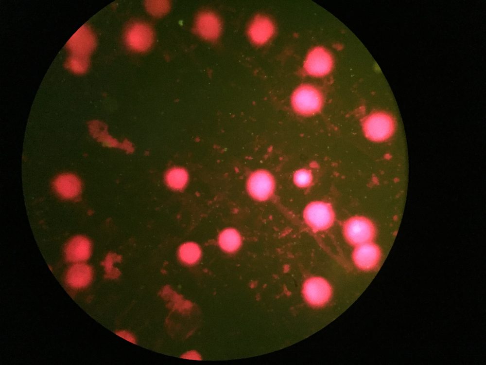 Chlamydia with elementary Cell (green Color)
