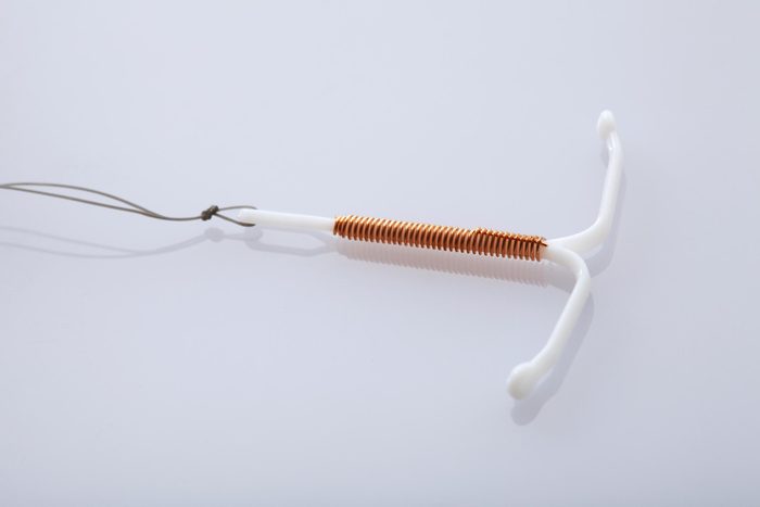 IUD intrauterine device endometriosis