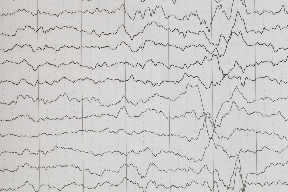 Onda cerebrale sull'elettroencefalogramma, sfondo onda EEG