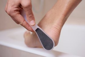 What Really Causes Cracked Heels—and How to Get Rid of Them | Reader's ...