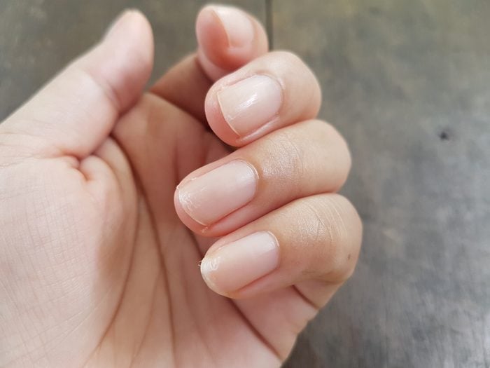 Close up of nails that have problem by peeling after doing manicure. Health and beauty problem. 