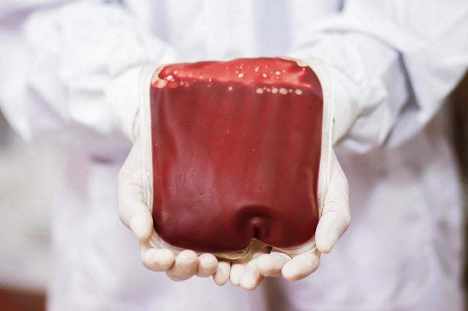 blood bag doctor transfusion