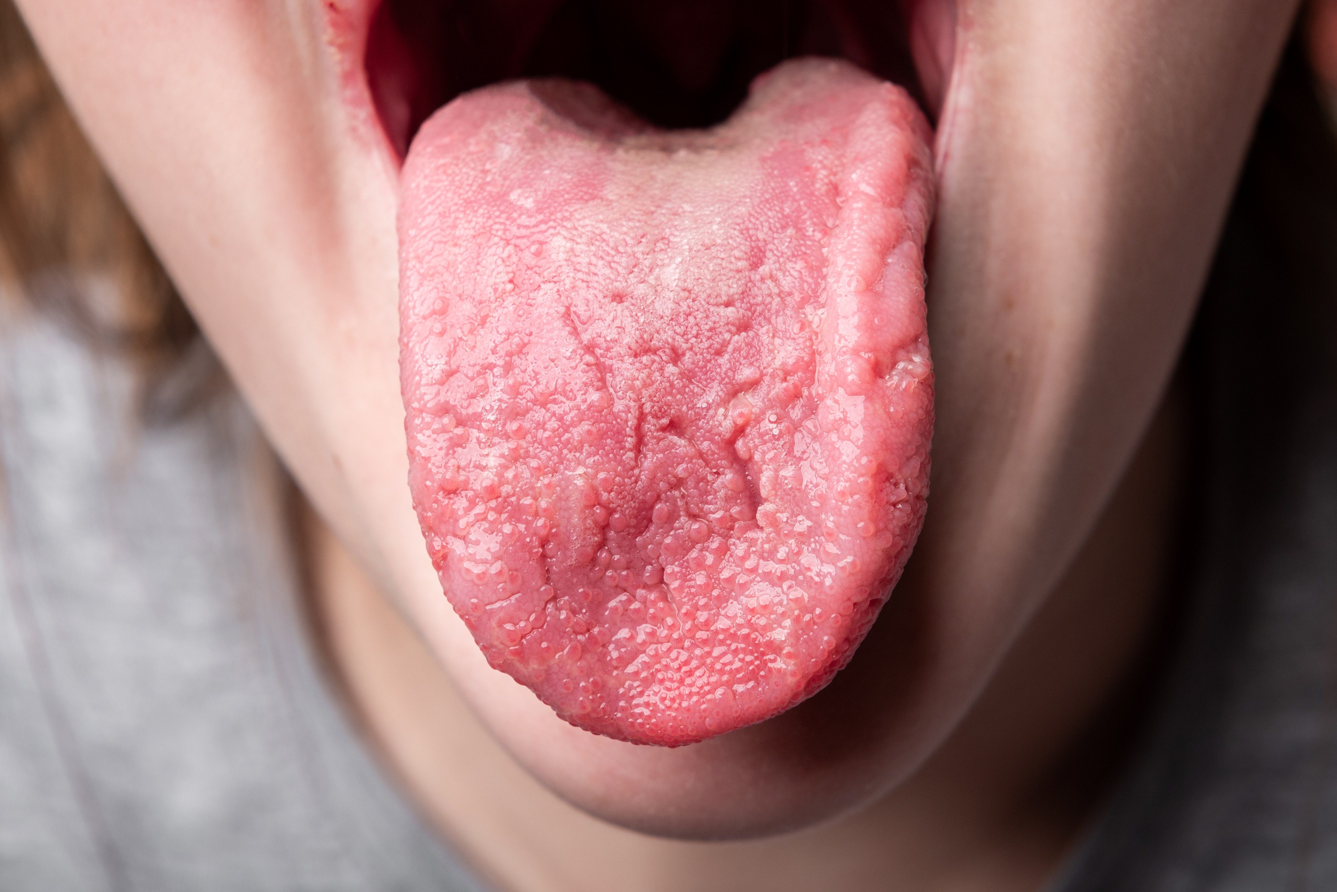 Image result for What Your Tongue can Tell you about your Health