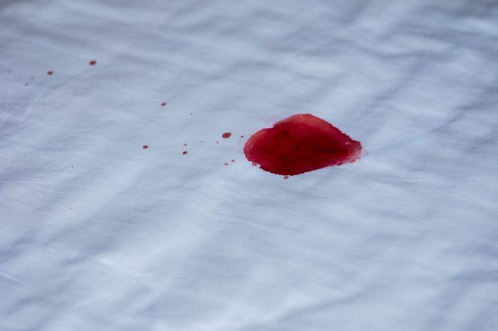 Drops of blood on a white cloth background.