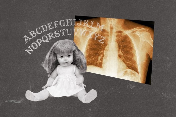 Ouija letters collaged with x-ray chest scan and doll