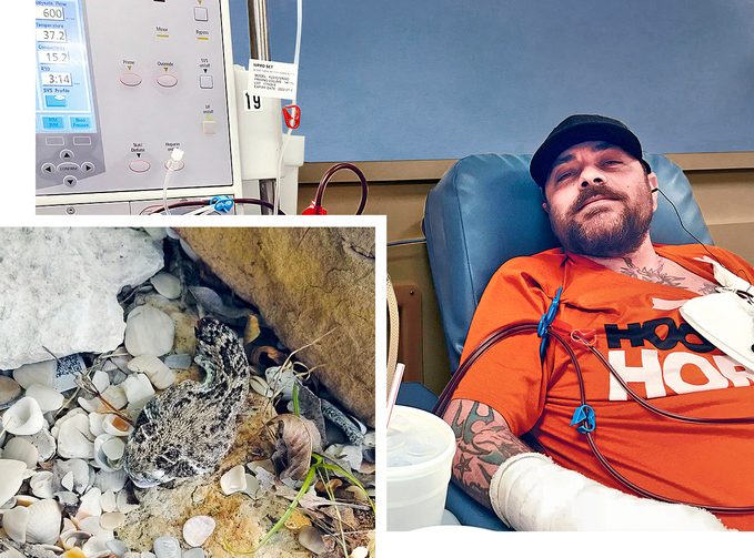 beheaded snake and jeremy sutcliffe in the hospital