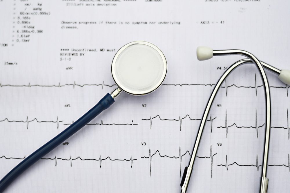Healthy concept: Stethoscope and electrocardiogram (ECG, EKG).