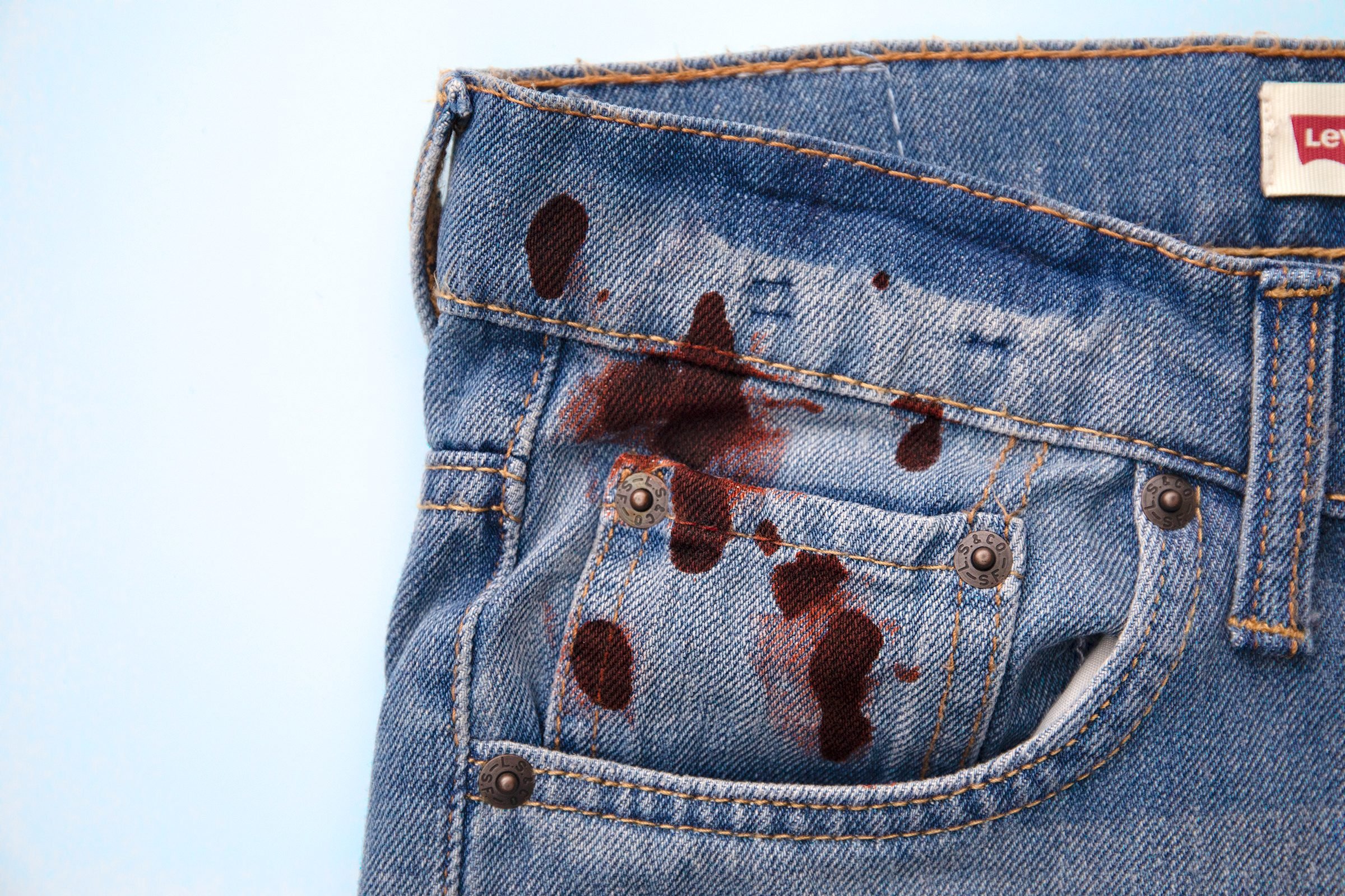How to Remove Blood from Clothes After 24 Hours? 
