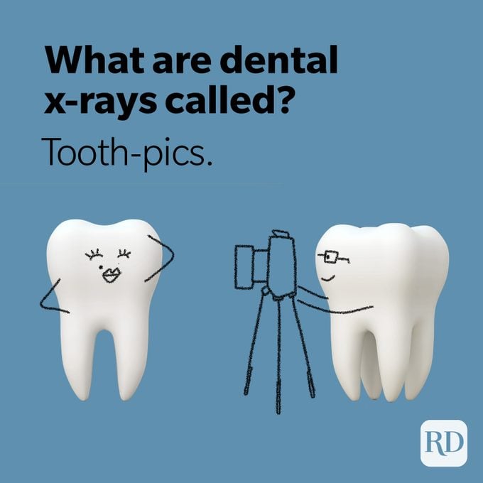 Tooth pics x-ray joke