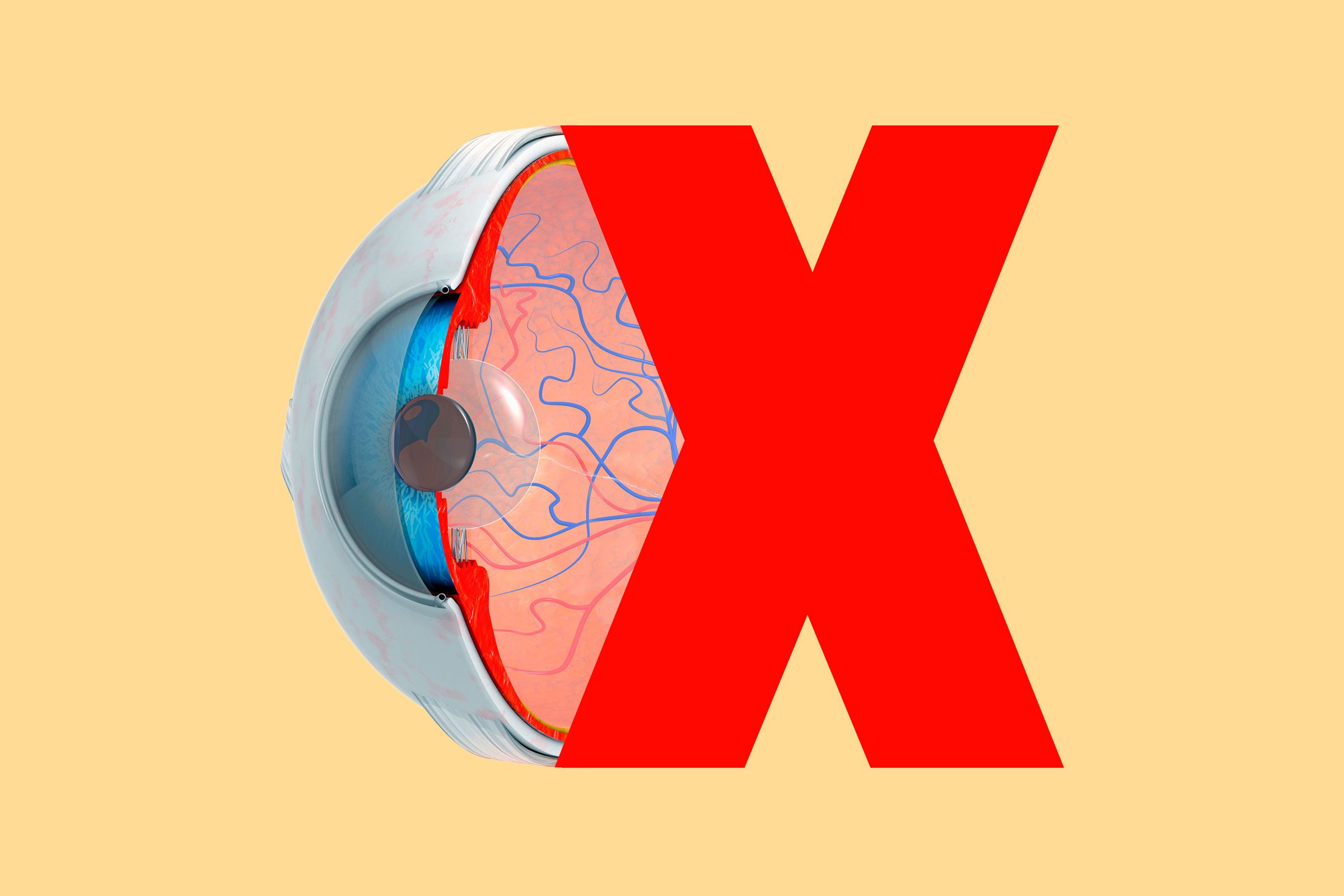 մարդկային աչքի խաչմերուկ՝ կոլաժված կարմիր x-ով դեղին ֆոնի վրա