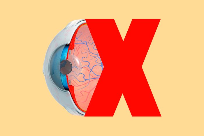 cross section of human eye collaged with red x on yellow background