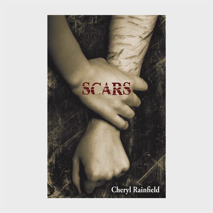 Scars By Cheryl Rainfield