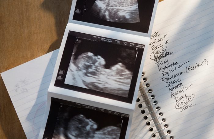 Ultrasound picture of baby with list of names