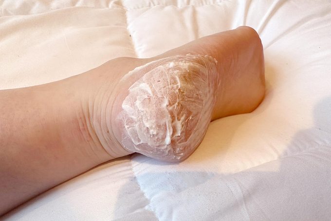 Foot Cream on the heal of a foot