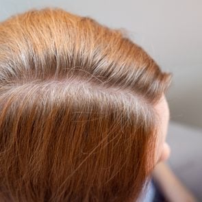 woman shows regrown hair roots. long dyed hair, growing natural color. gray.