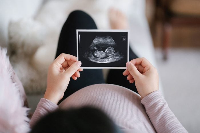 Young Asian pregnant woman lying on sofa at home, looking at the ultrasound scan photo of her baby