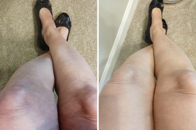 Before And After Body Perfector on legs